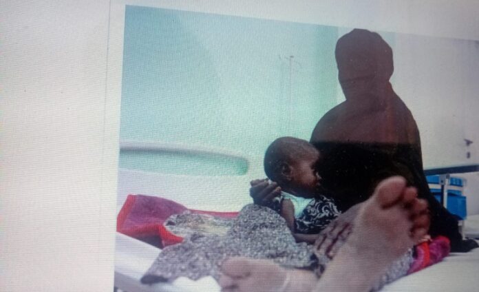 Abaaraha oo halis geliyay carruurta Soomaaliyeed