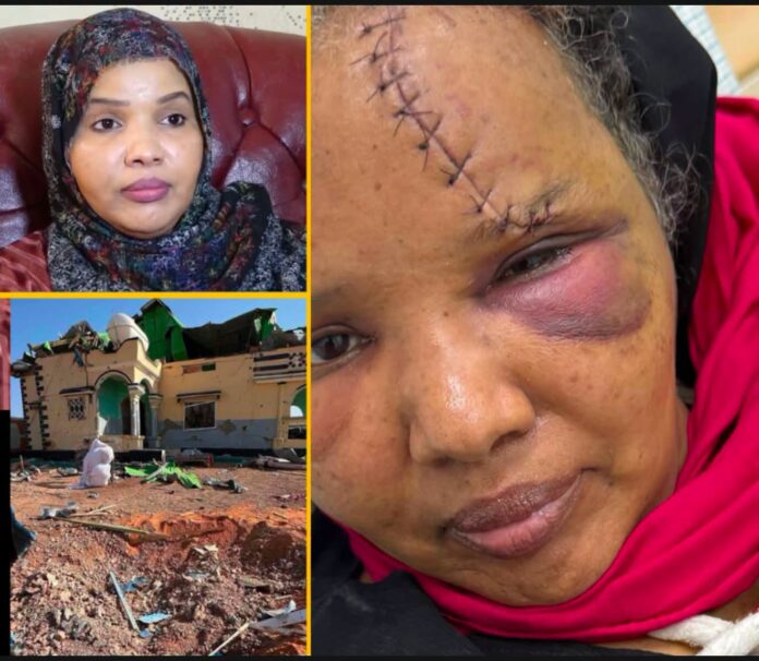 Suuban Mahad Dirir oo ka hadashay dhaawacyadii kasoo gaaray duqeyntii Doolow+Sawirro